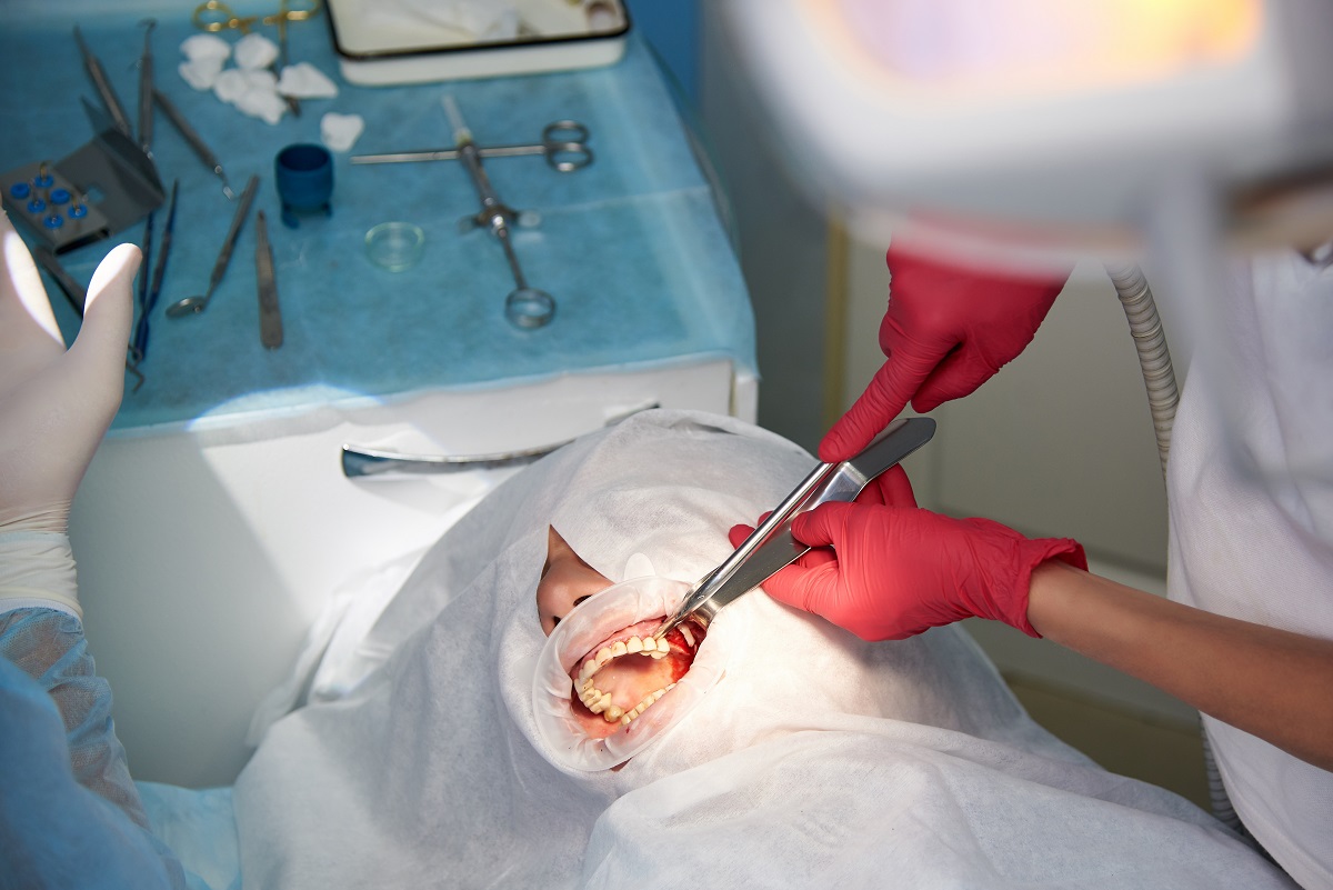 Na czym polega lifting stomatologiczny? Jakie są przeciwwskazania do jego wykonania?